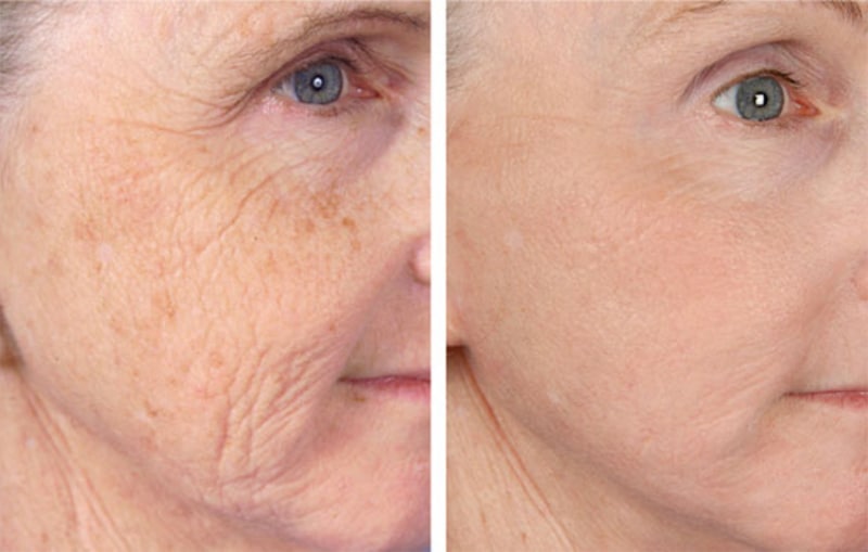 7 Everyday Habits That Secretly Age Your Skin (And How to Stop Them)